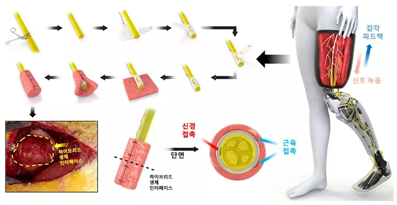 절단환자 위한 로봇 팔·다리 정밀 제어 '생체인터페이스' 개발