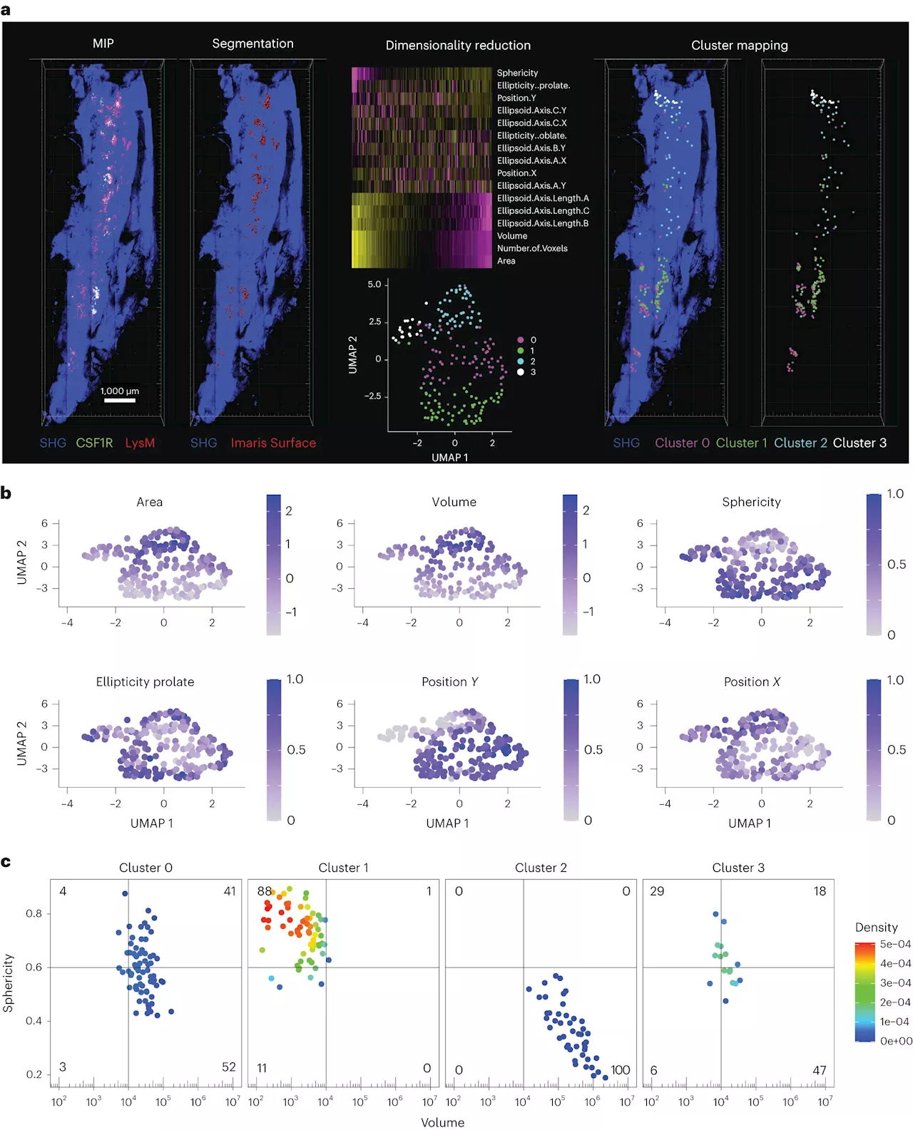 New imaging method reveals activity of cells that break down bone