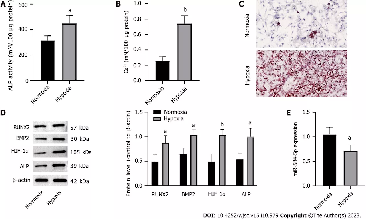 Researchers report effect of hypoxia on periosteal stem cells