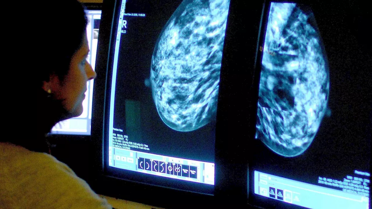 Thousands of breast cancer cases missed by NHS screening, campaigners warn...