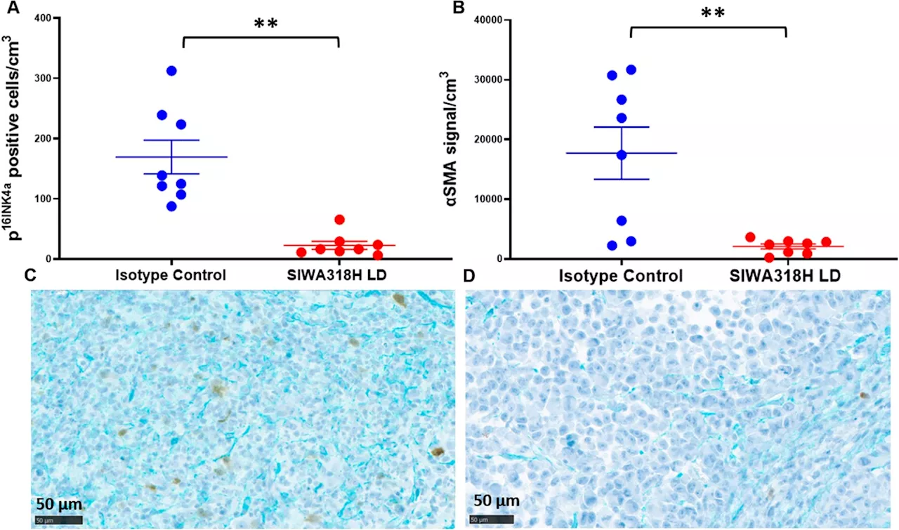 New antibody shows strong potential as treatment against pancreatic cancer