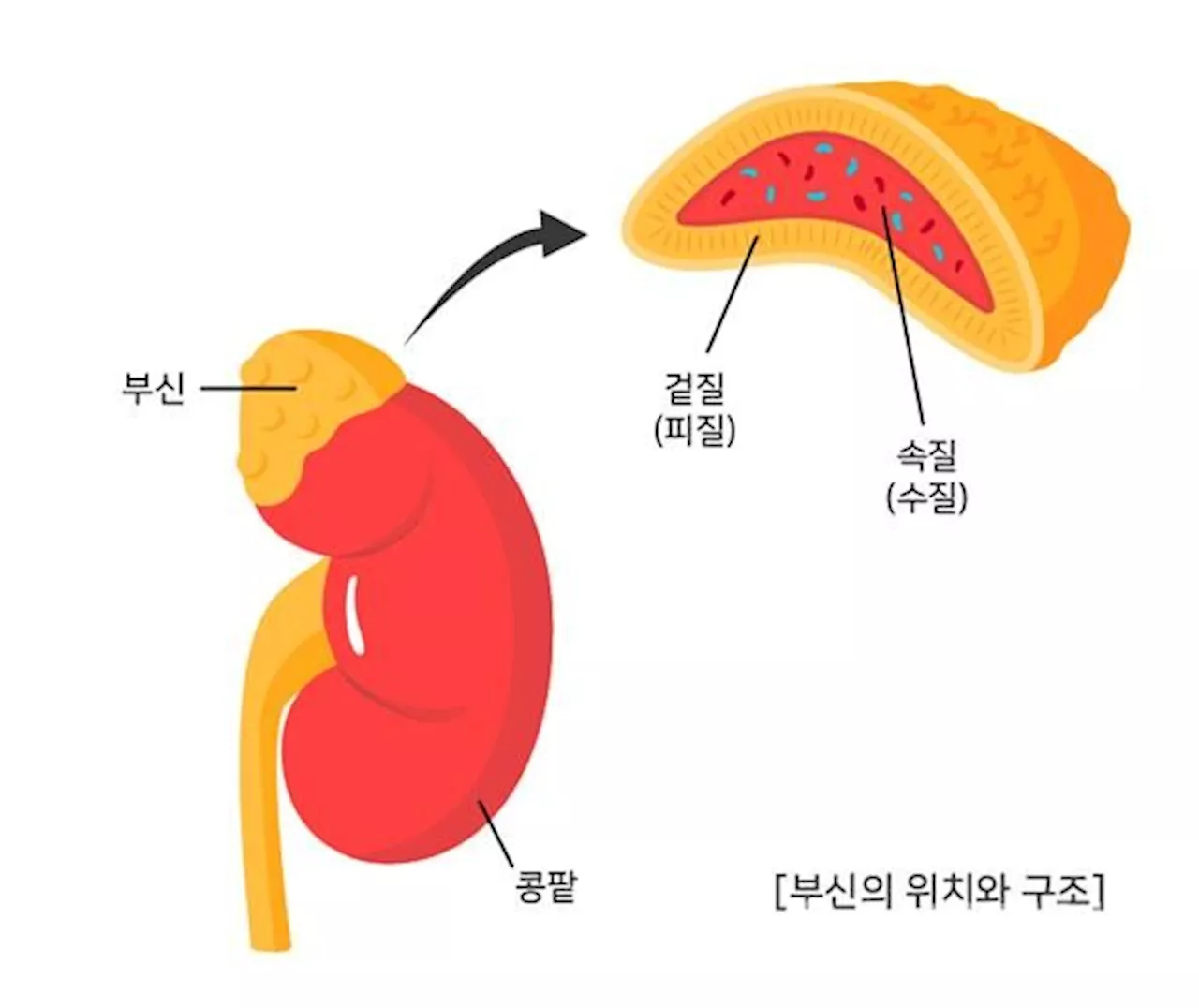 생소한 부신질환, 수술 방법과 시기는?