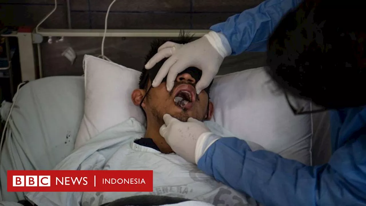 Kasus cacar monyet muncul lagi di Indonesia, apa saja yang perlu diketahui?