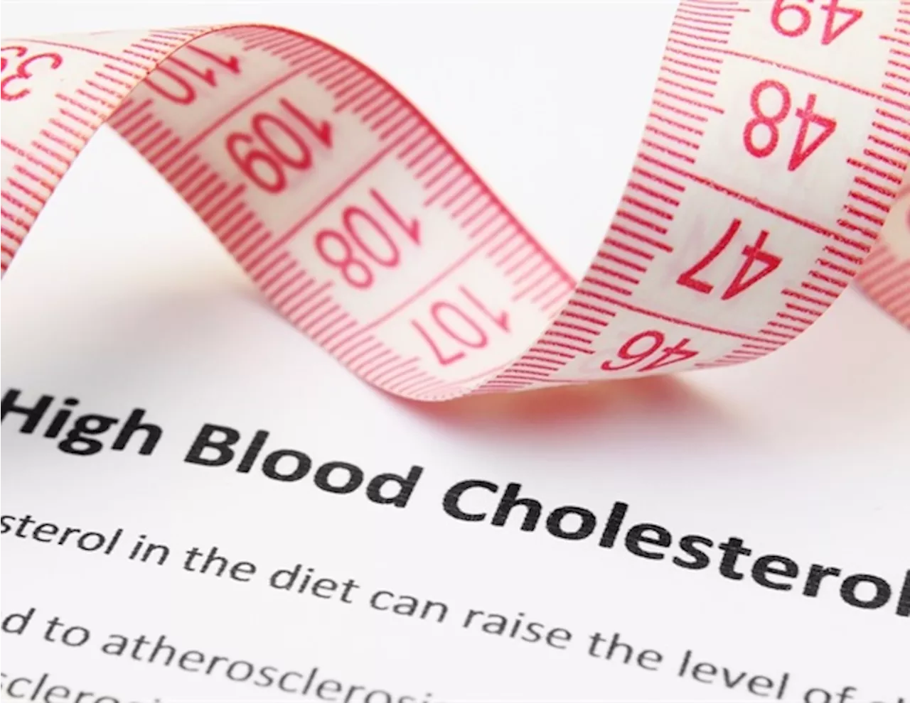 Experts warn of 'silent epidemic' of high cholesterol in the UK