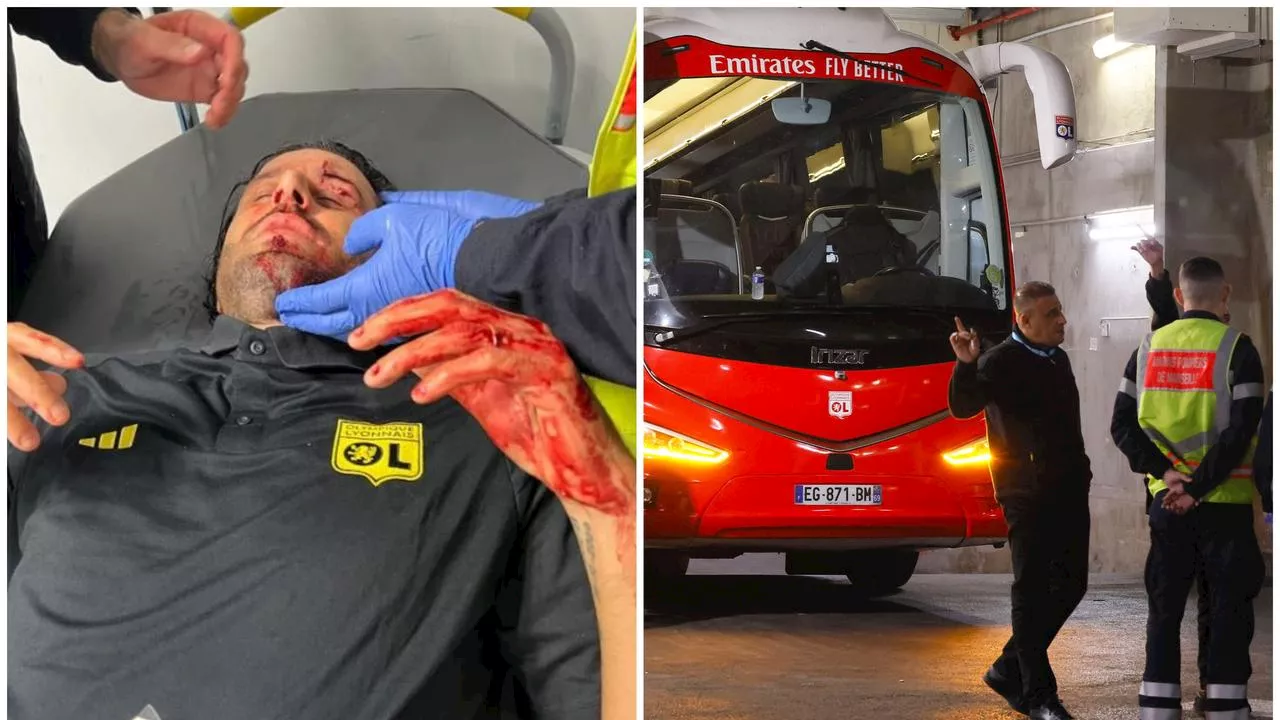 ‘Revolting’ images shock football as great left bloodied, match scrapped after fan bus attack