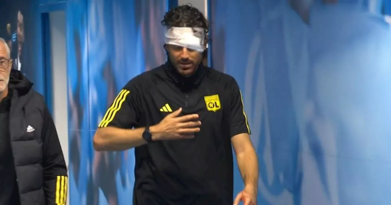 Lyon manager Fabio Grosso left bleeding after Marseille fans attack team bus