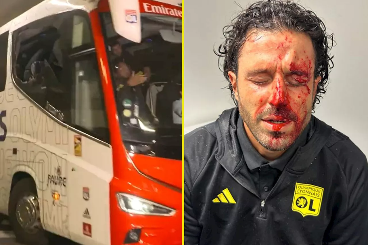 Lyon Manager Injured as Team Bus Attacked by Marseille Fans