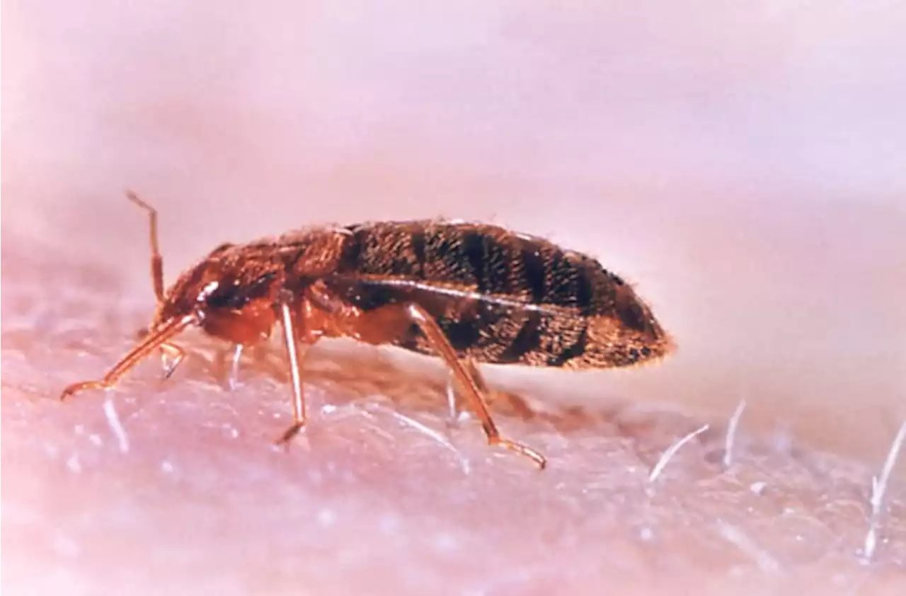 Bedbugs bite into Paris, stoking fears ahead of the Olympics