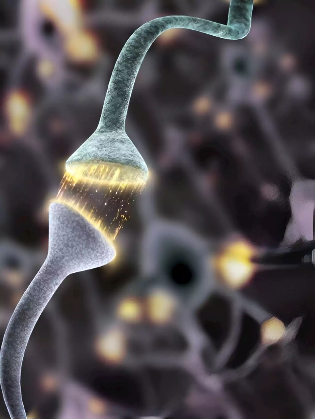 Extra-large synapses could be a cause of schizophrenia