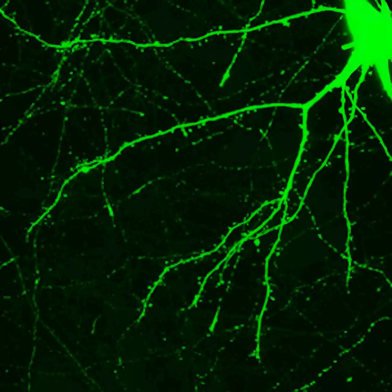 Psychedelics plus psychotherapy can trigger rapid changes in the brain: New research is untangling how