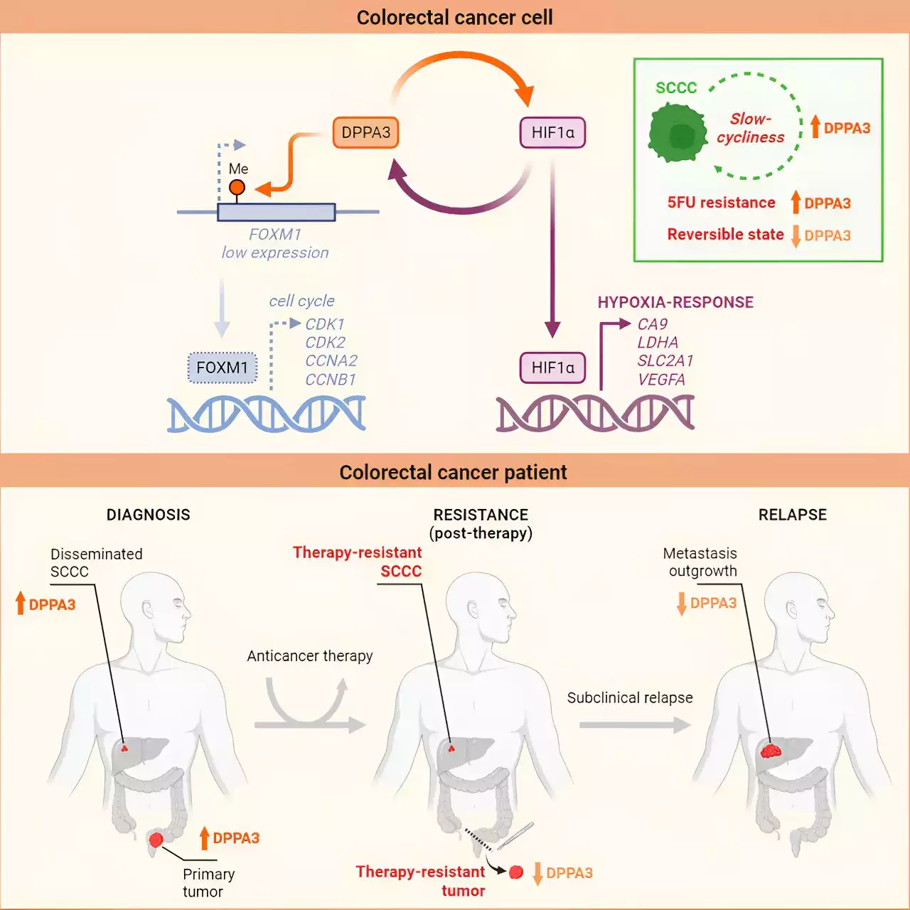 Study identifies a novel regulator of dormant cancer cells and chemoresistance in colorectal cancer