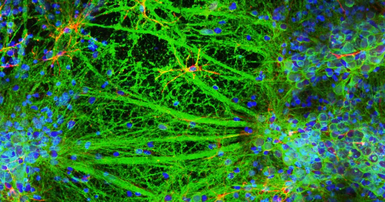 A Lab Just 3D-Printed a Neural Network of Living Brain Cells