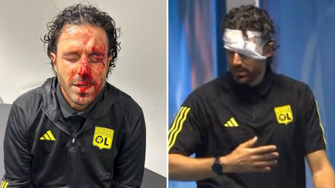 Lyon Coach Fabio Grosso Injured in Fan Attack, Match Called Off