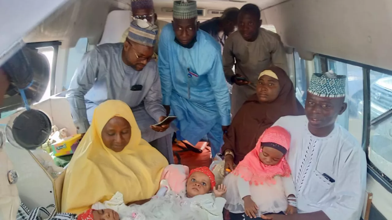 Kano Conjoined Babies Flown To Saudi Arabia For Separation