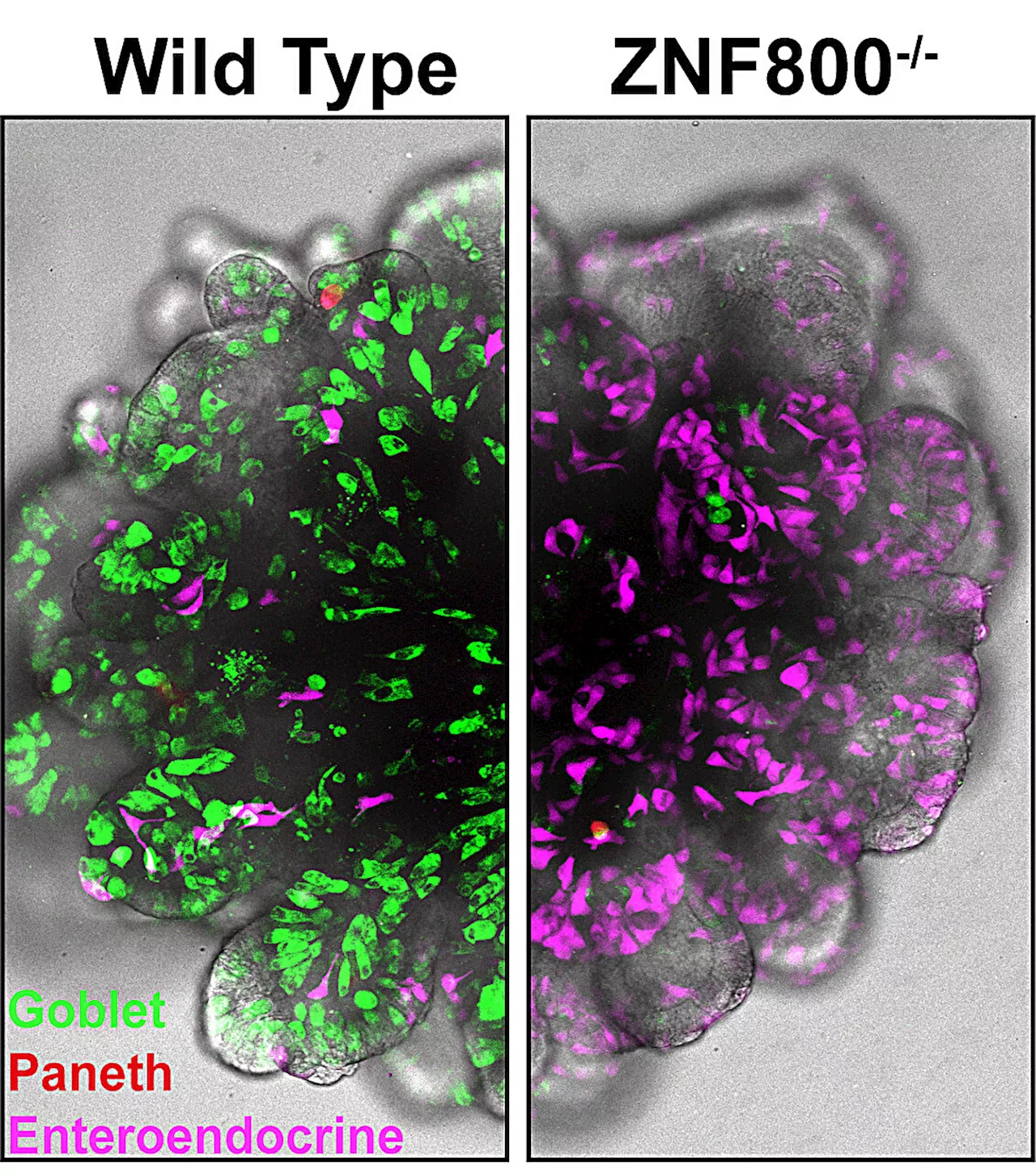 Human organoid research identifies crucial 'traffic light' in gut cell differentiation