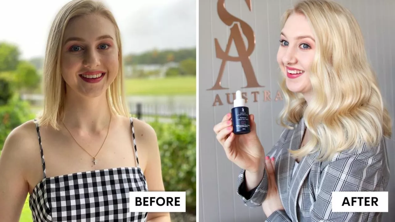 Touching secret behind Aussie’s brand - after founder lost her locks following diabetes diagnosis