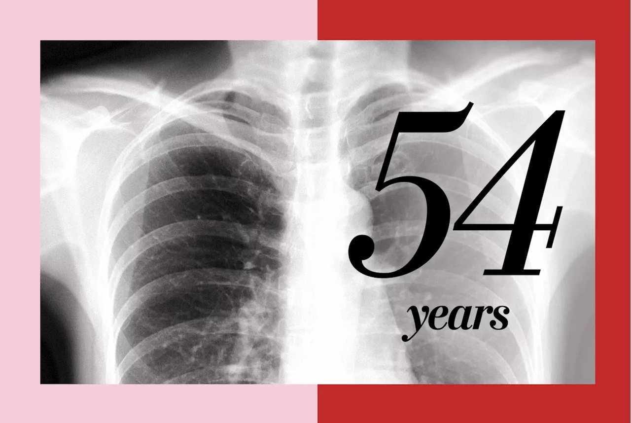 Lung cancer is more common among women than men ages 35 to 54