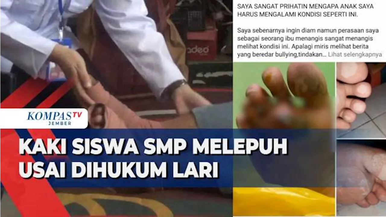 Dihukum Lari di Siang Hari, Kaki Siswa SMP di Madiun Melepuh