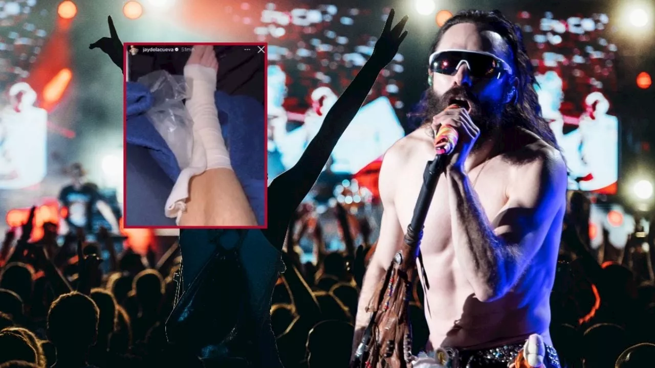 Así fue el accidente de Jay de Moderatto en el Teatro del Pueblo de la Feria Pachuca