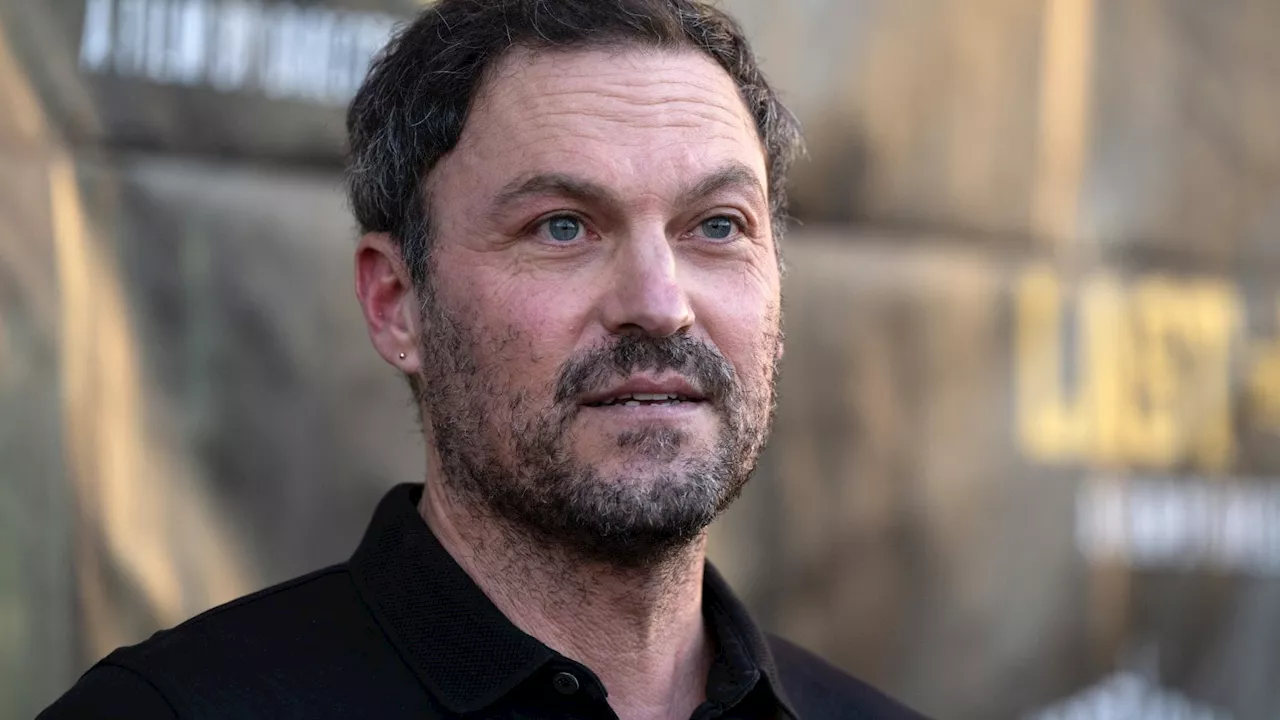 Brian Austin Green: 'Sono stato male per anni: pensavo a postumi da ictus, ma era un problema alimentare'