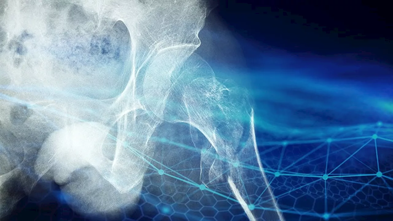 New AI May Slash High Mortality Rate After Hip Fractures