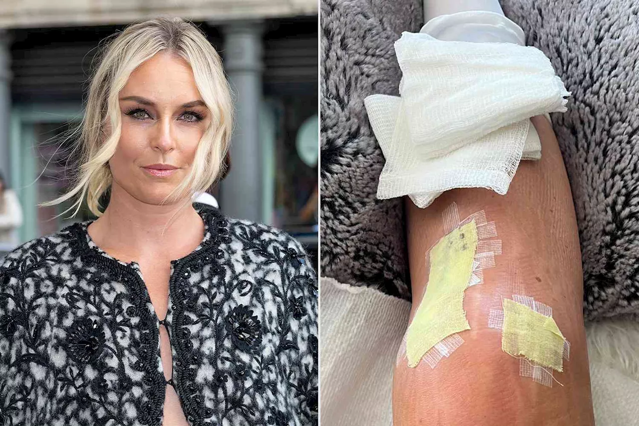 Lindsey Vonn Reveals She’s Preparing to Undergo Knee Replacement Surgery