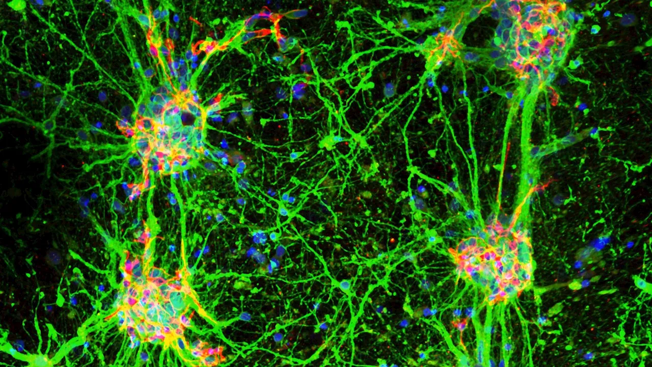 Here's how scientists are 3D-printing living brain networks