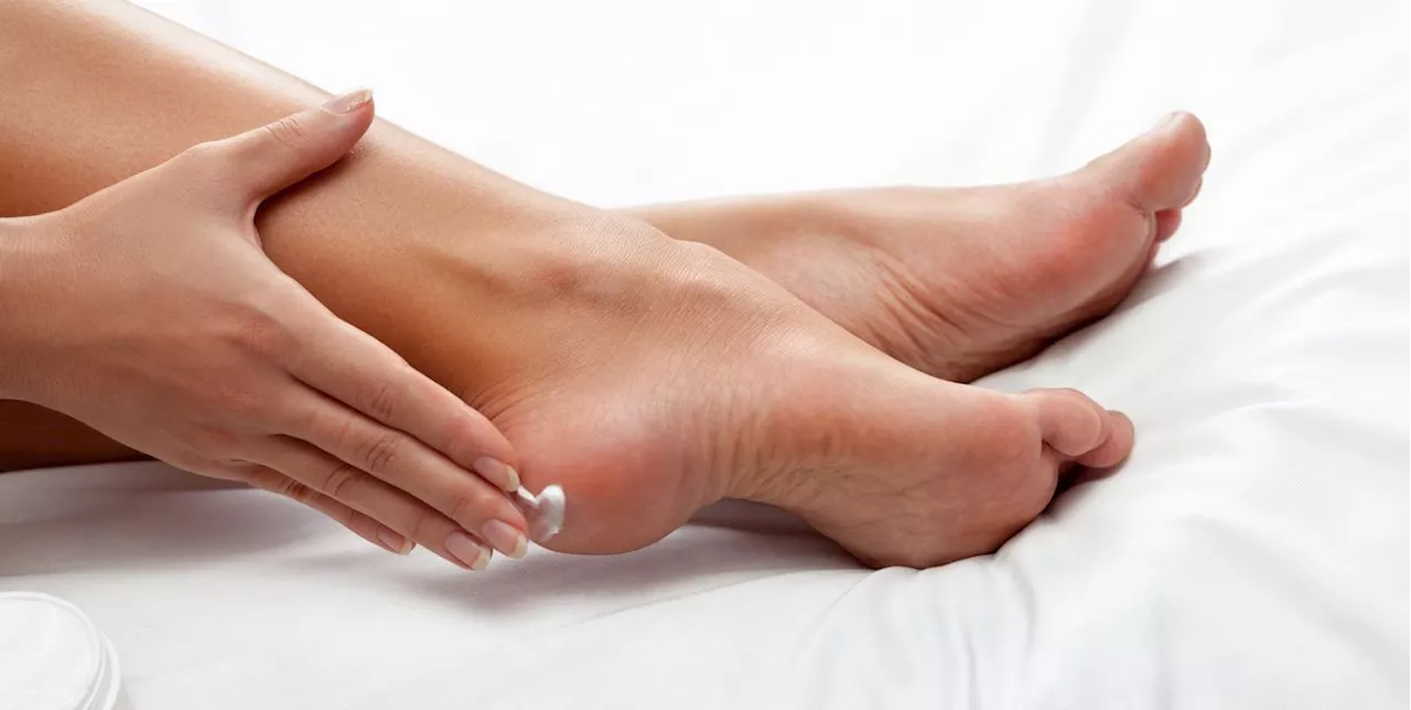 13 Best Foot Creams to Soothe Dry, Cracked Feet, According to Dermatologists