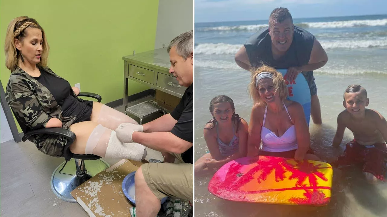 Ohio woman who lost all four limbs to flu complications speaks out to raise awareness