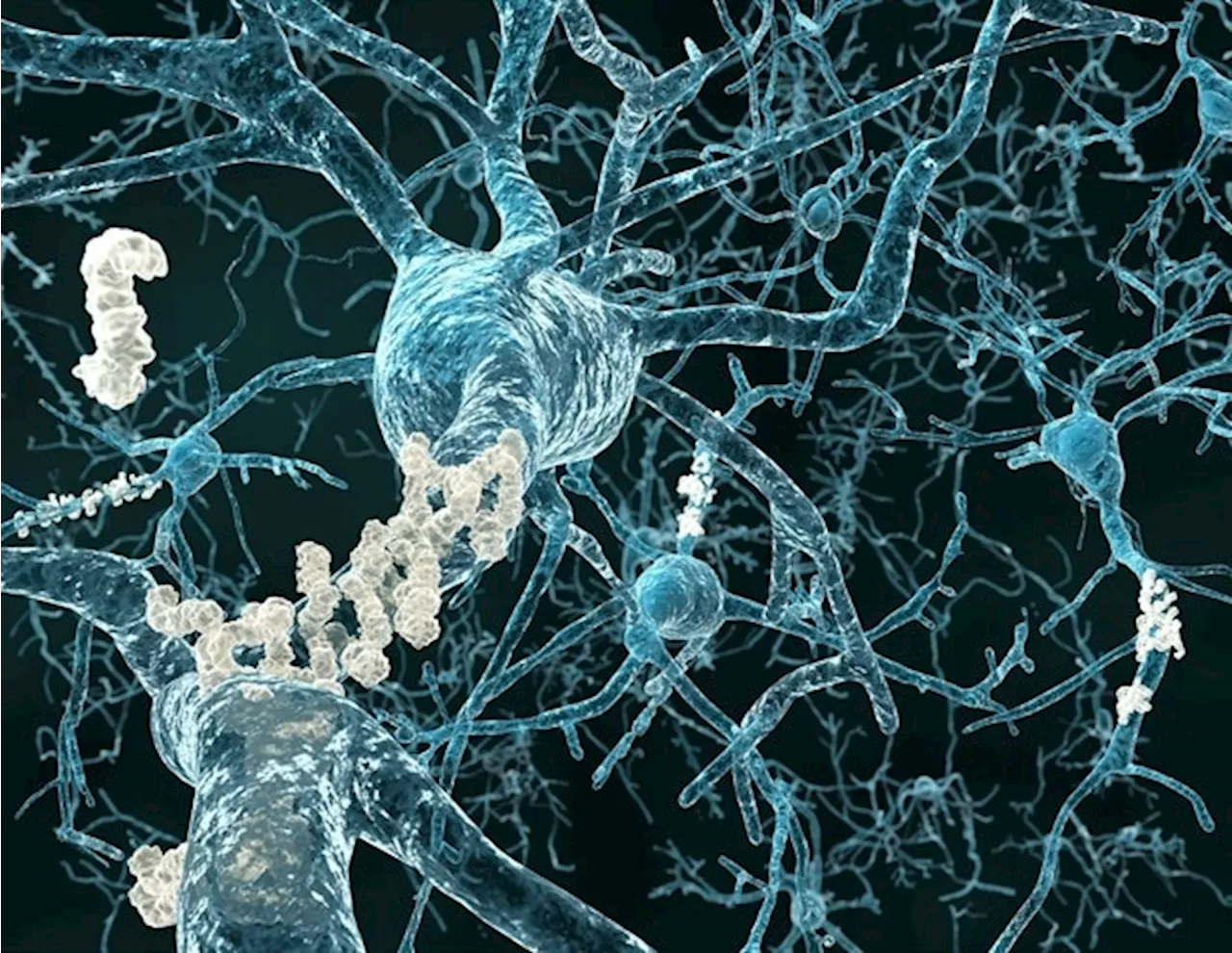 Advances in understanding and detecting Alzheimer's disease