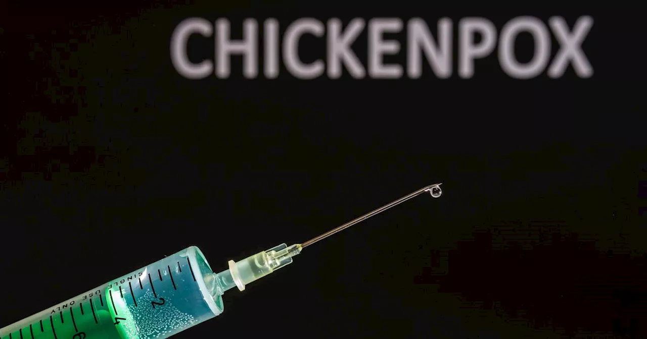 Chickenpox vaccine could be introduced for young children in Northern Ireland