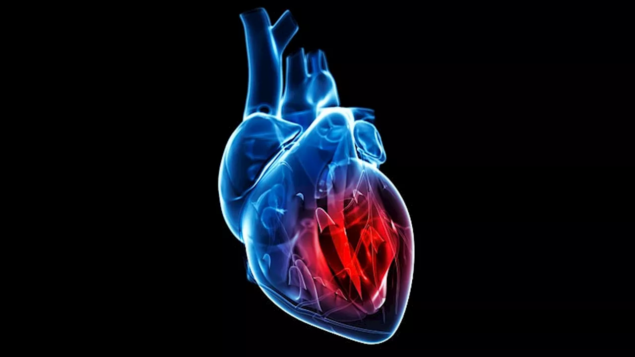 Improved Cardiometabolic Outcomes with Dapagliflozin in DAPA-MI Trial