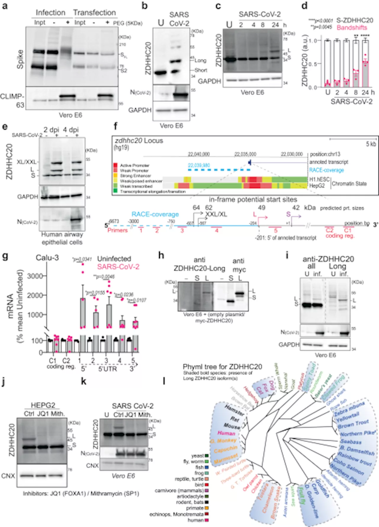 SARS-CoV-2 Infection Enhances Spike Protein Acylation and Fusion Activity