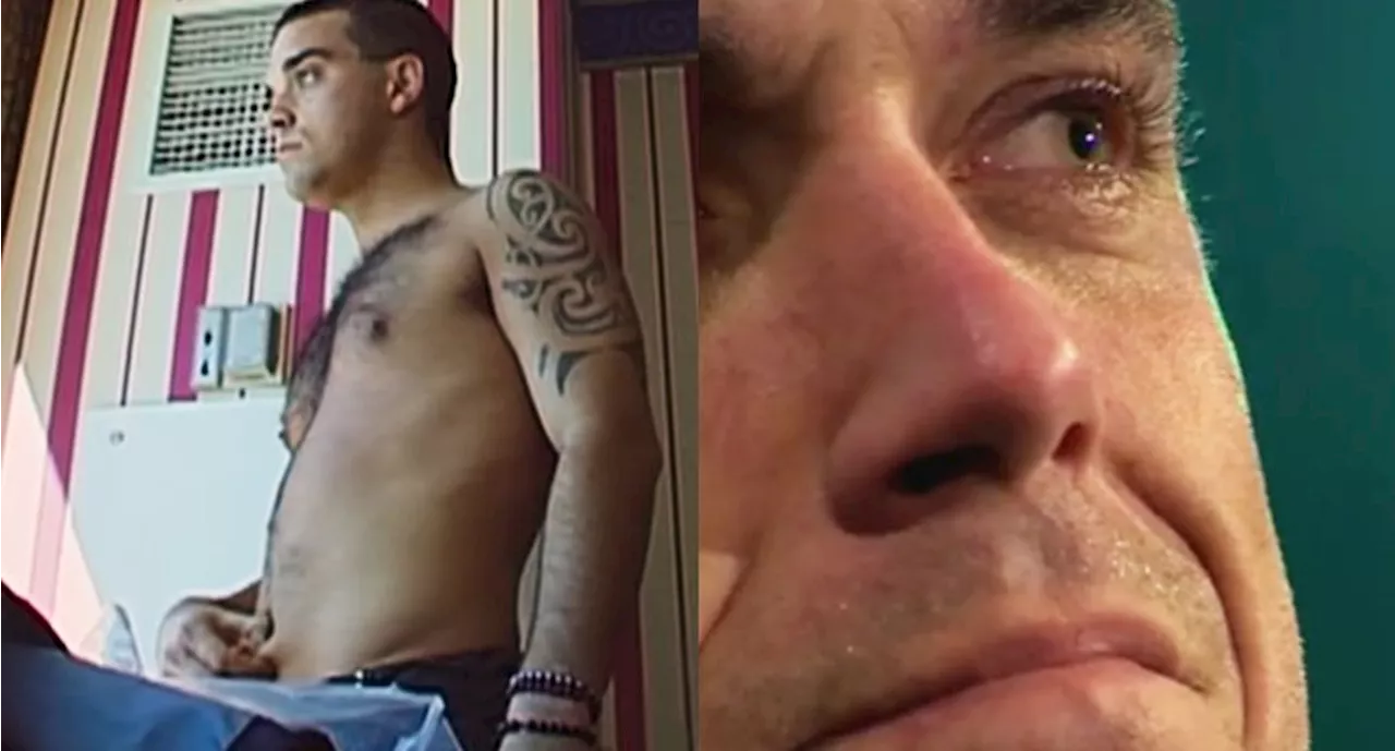 Robbie Williams habla de la anorexia que padecía: 'Comía sólo un plátano al día'
