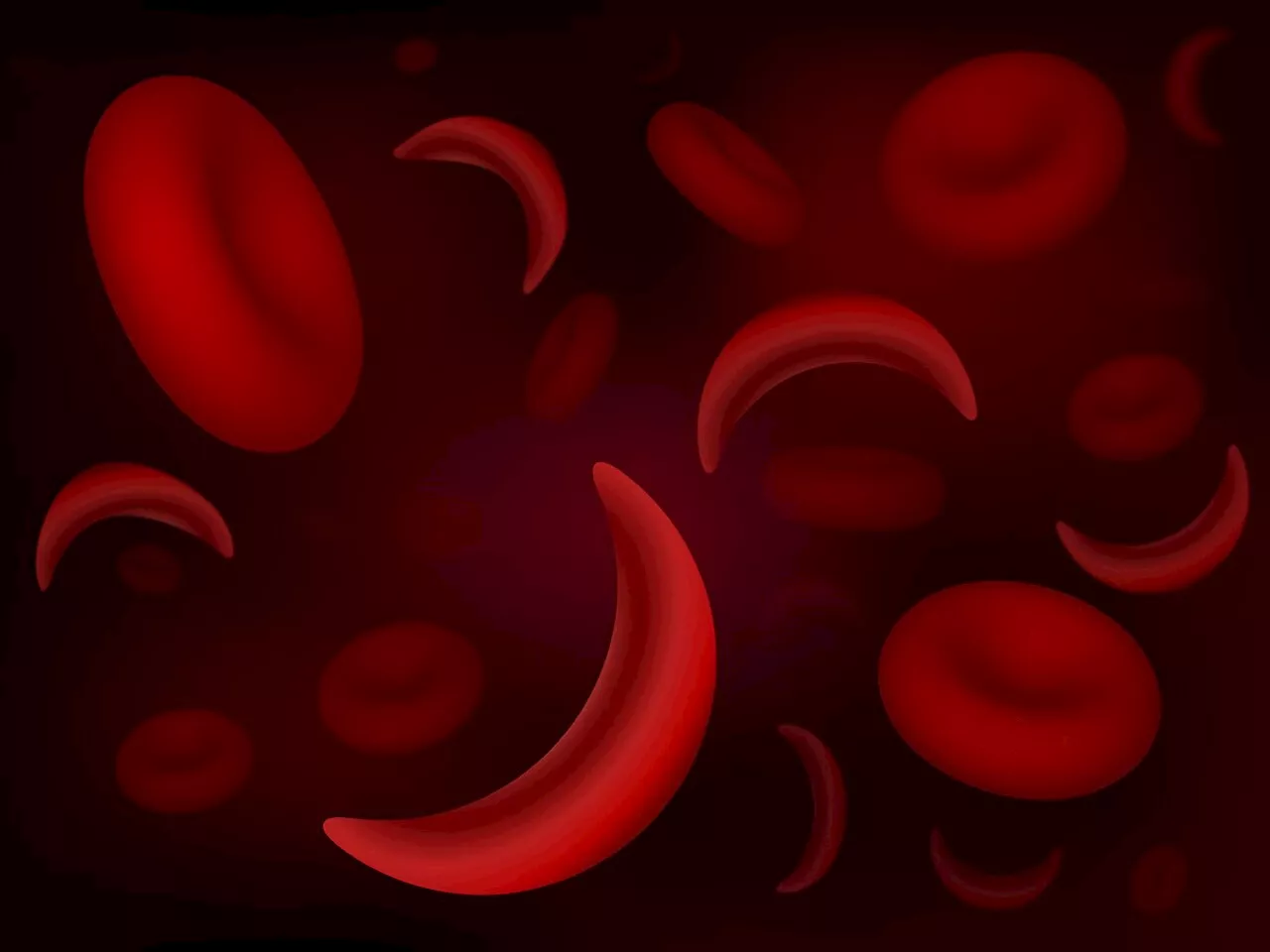 FDA advisors say new gene therapy for sickle cell disease is safe