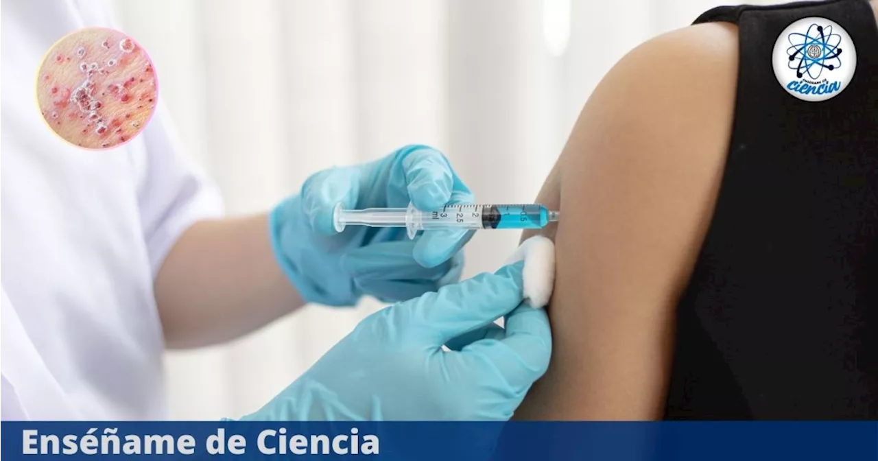 Herpes Zóster: una enfermedad viral y dolorosa