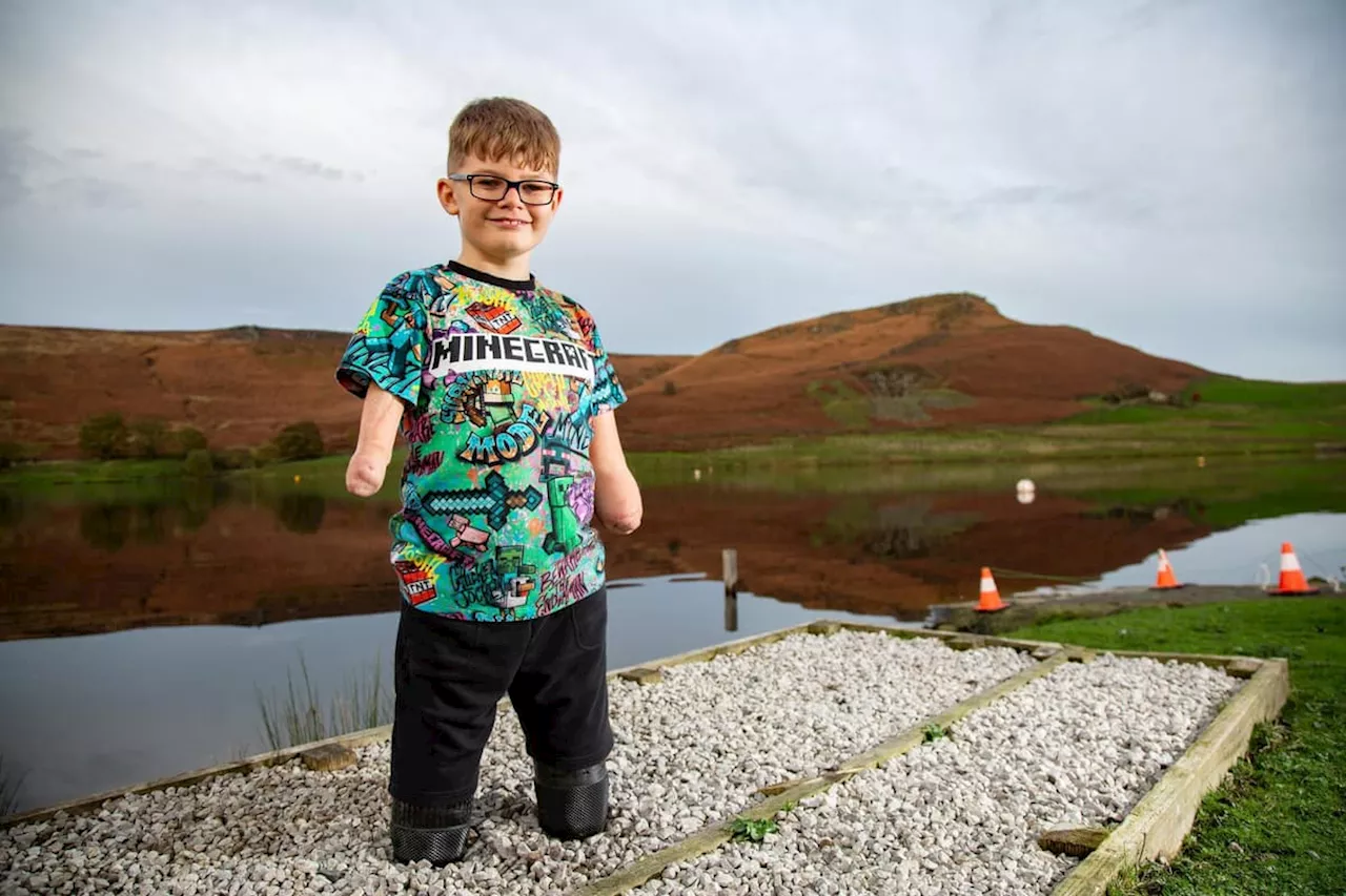 Teenager with no arms or legs raises thousands for charity with sponsored climb