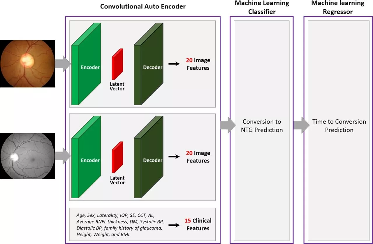 AI able to predict if and when people at high risk progress to glaucoma