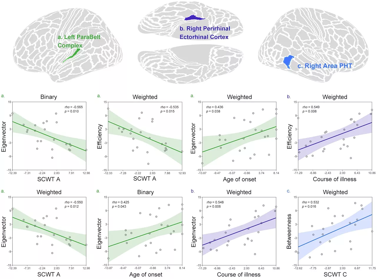 Brain study uncovers new insights into major depressive disorder in adolescents