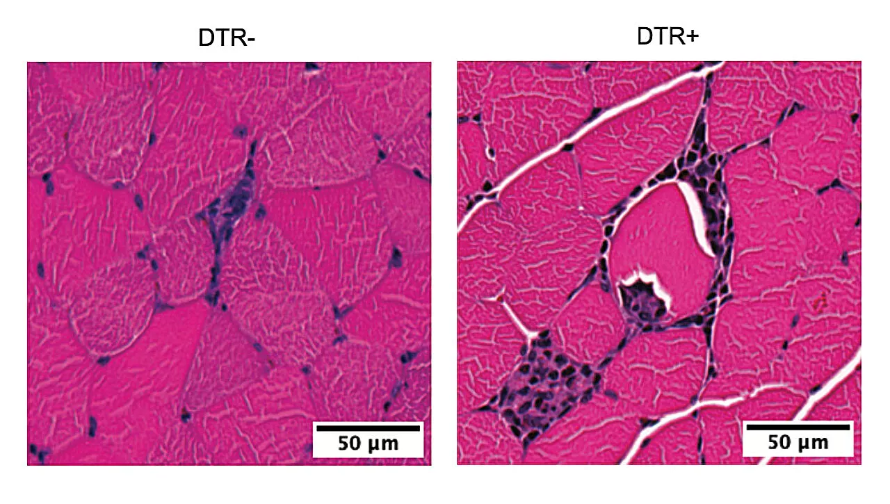 Some benefits of exercise stem from the immune system, suggests new study