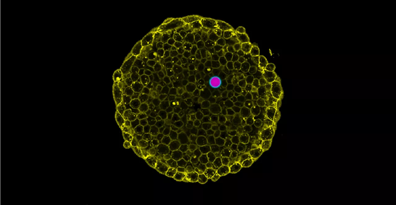 Researchers can now visualize osmotic pressure in living tissue