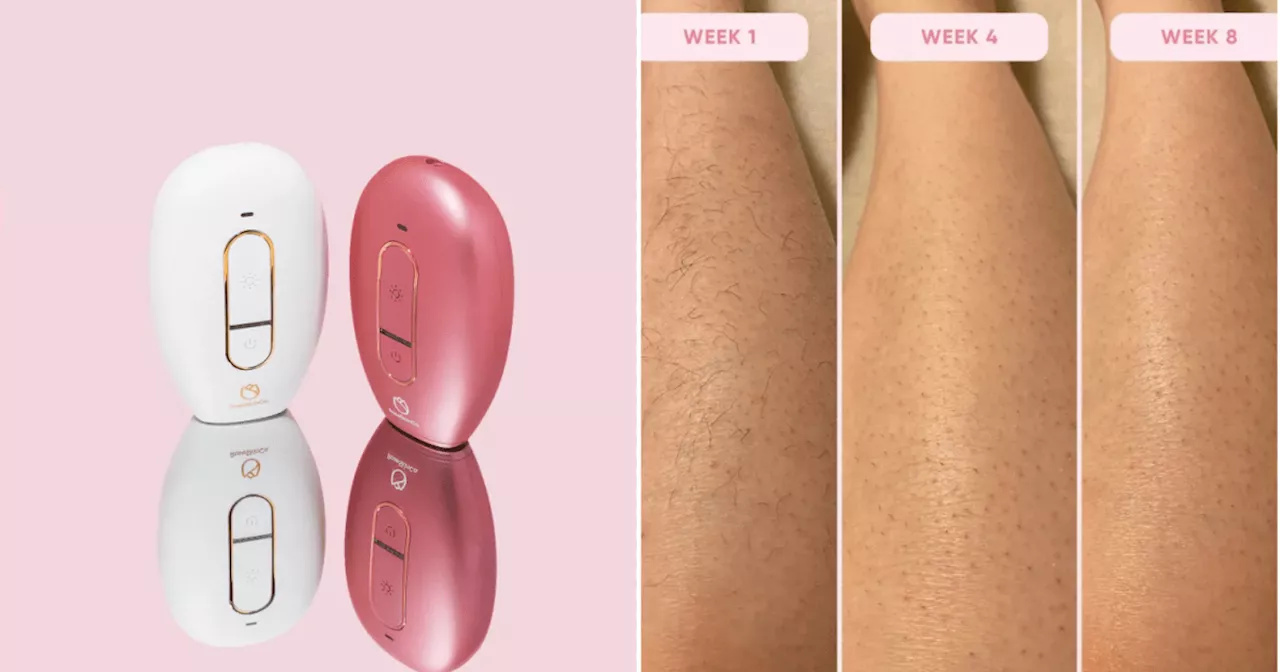 Shoppers declare this hair removal device 'life changing'