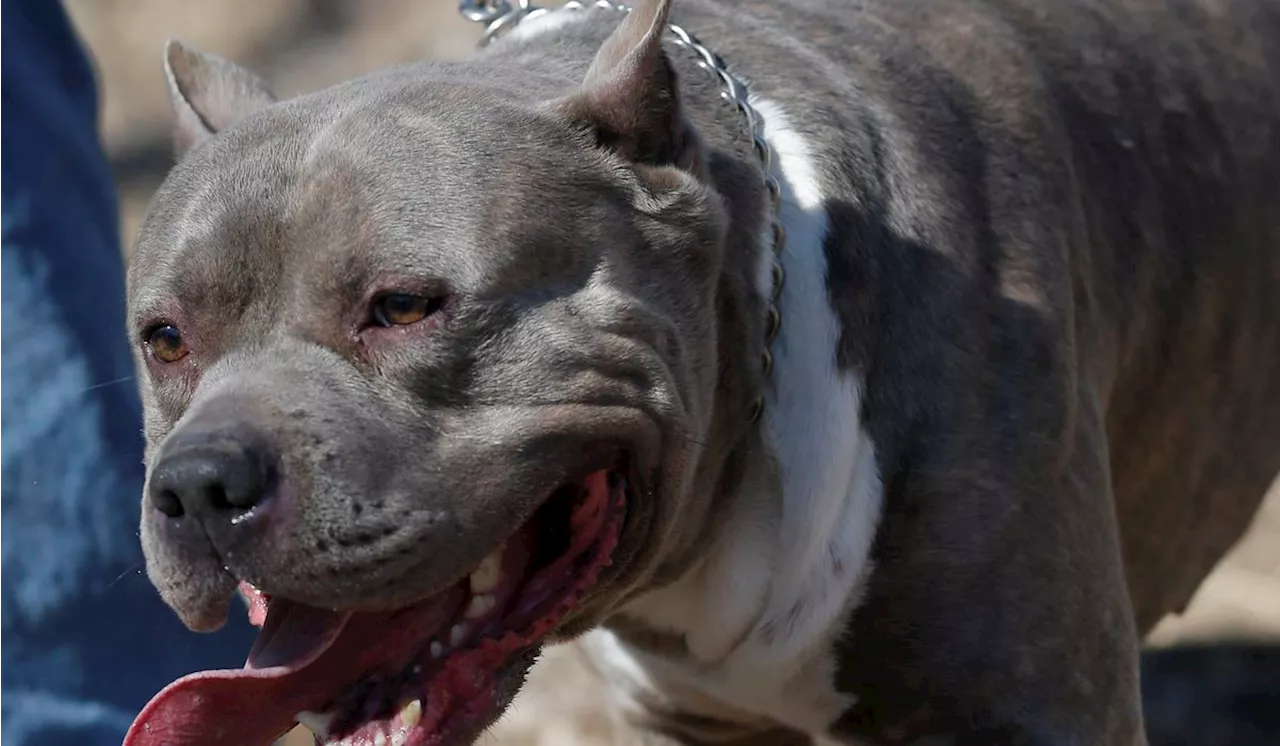 Utah woman has leg amputated after being attacked by her son's pit bulls