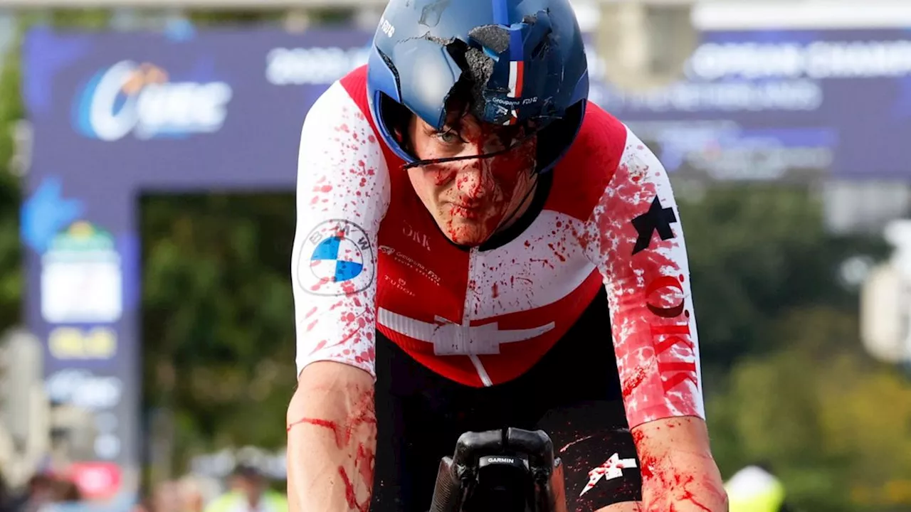 Rad-Star: Stefan Küng vermisst seit blutigem Crash seinen Ehering