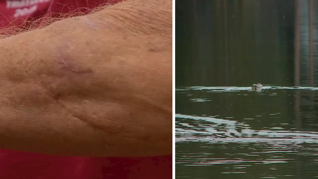 Wildlife experts caution travelers after otter attacks swimmer in Placer County lake