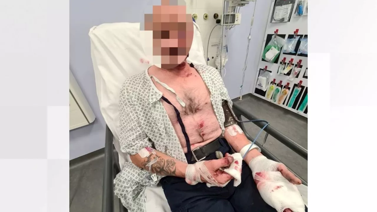 Man loses two fingers after discarded firework 'goes off' in hand in Liverpool