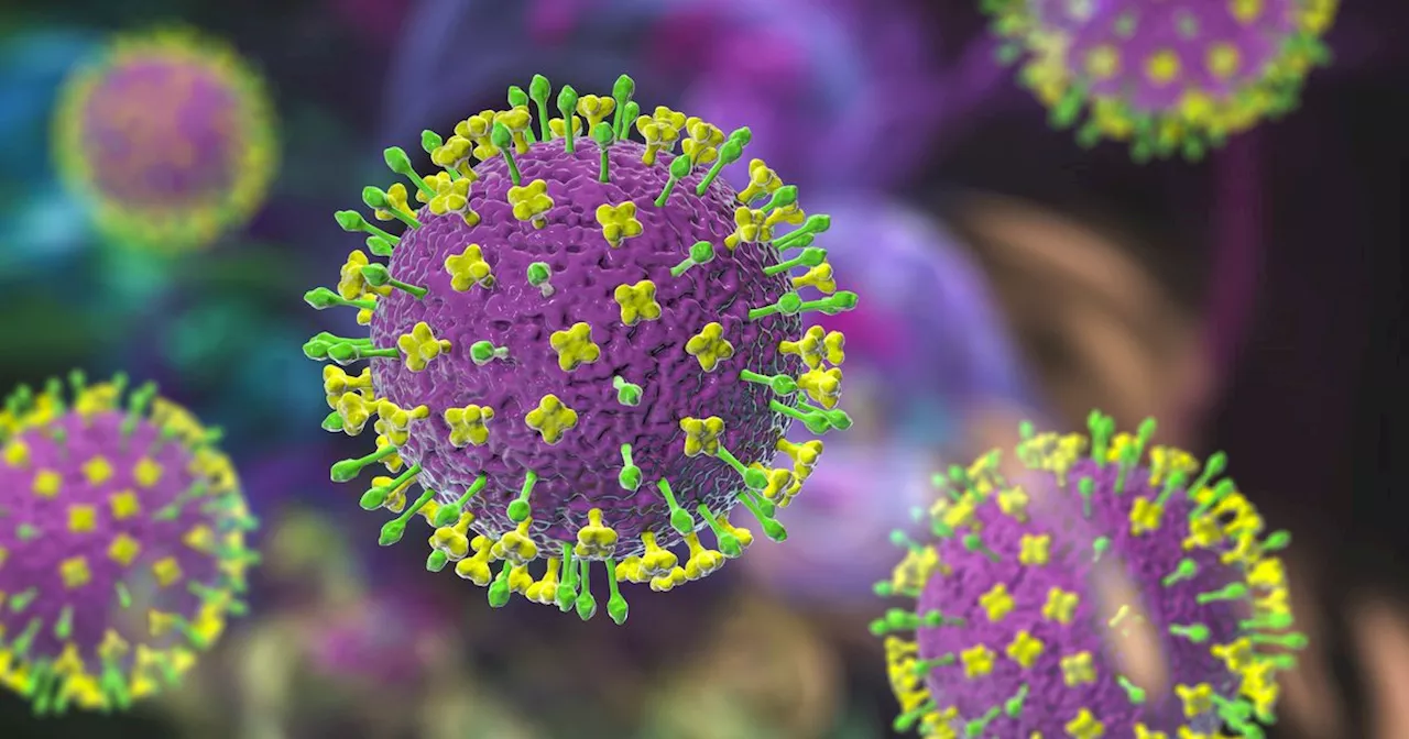 Scientists say virus could cause pandemic much worse than Covid