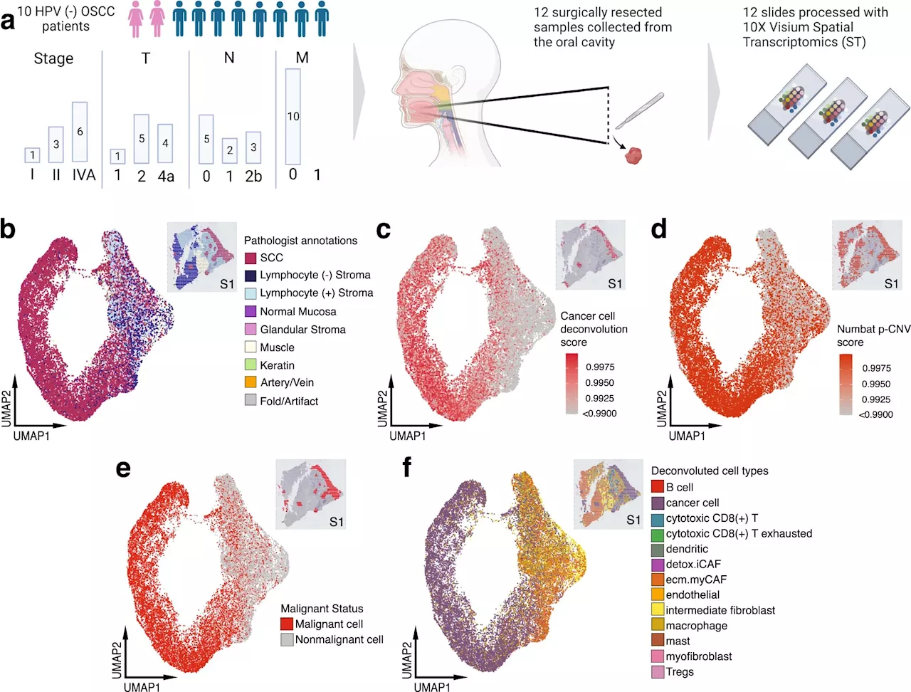 Researchers discover unique differences in cancer cells based on where they are in a tumor