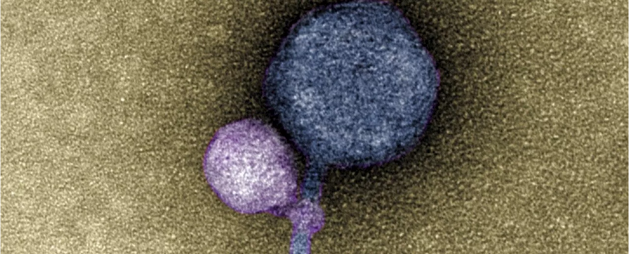 Bizarre First: Viruses Seen 'Biting' Onto Other Viruses Like Tiny Vampires