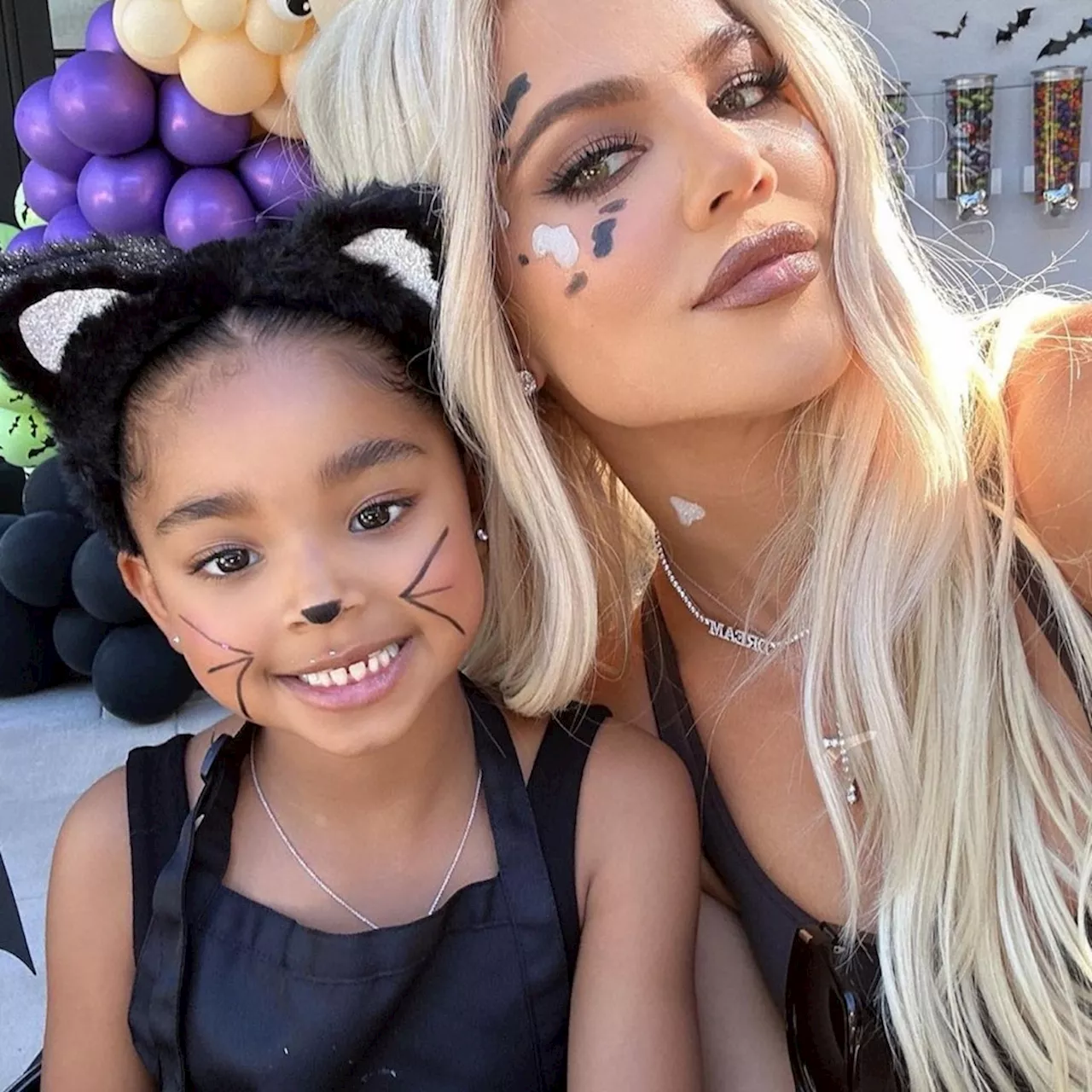 Khloe Kardashian's Daughter True Thompson Reveals How She Lost Her Front Tooth in Adorable Video